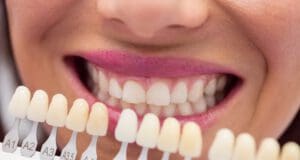 A fogfehérítők szerepe az egészséget tekintve
