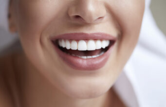 Dentálhigiénia: Hogyan őrizzük meg fogaink egészségét?